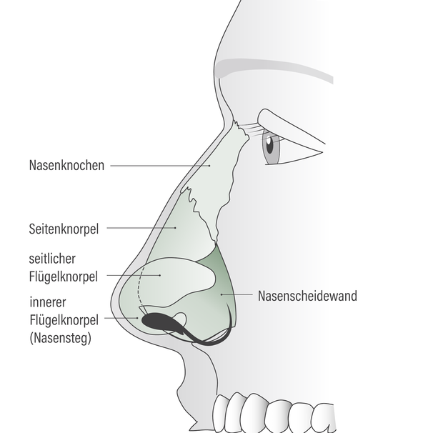 grafik-nase-04-hno-muenchen-dres-rother-kollegen.png 