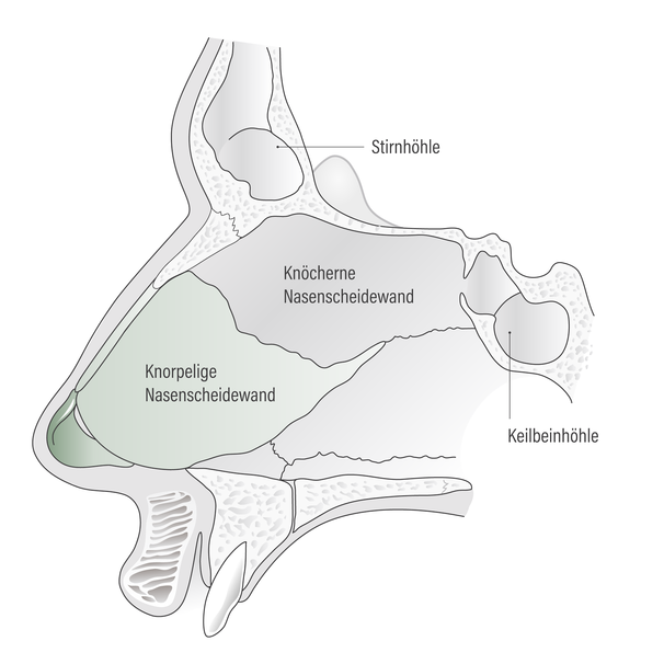 grafik-nase-01-hno-muenchen-dres-rother-kollegen.png 